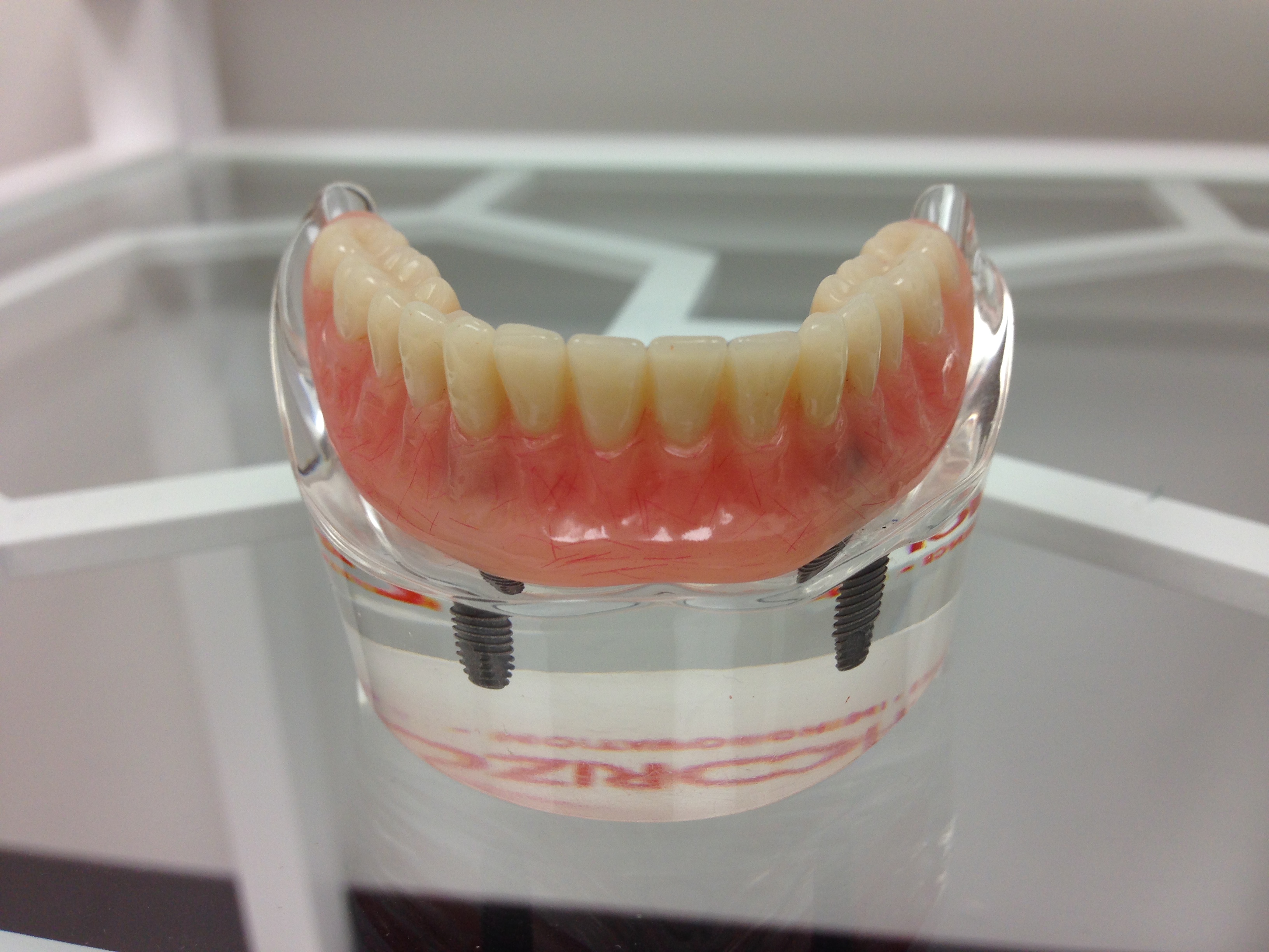 Dentures | Implants | Marion IL